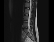 Relevantie van beeldvorming in de diagnostiek van veelvoorkomende orthopedische klachten (BG)